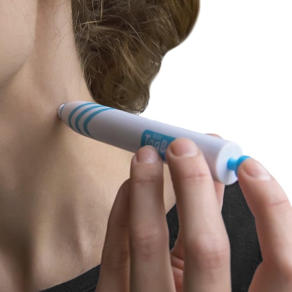 Skin Tag Remover Kit with 3.0 mm Remover for Home Use